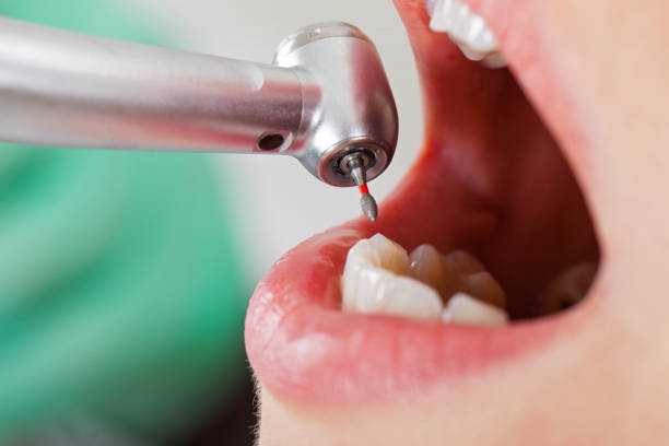 Best Emergency Dental Care for Sports Injuries in Central City, NE